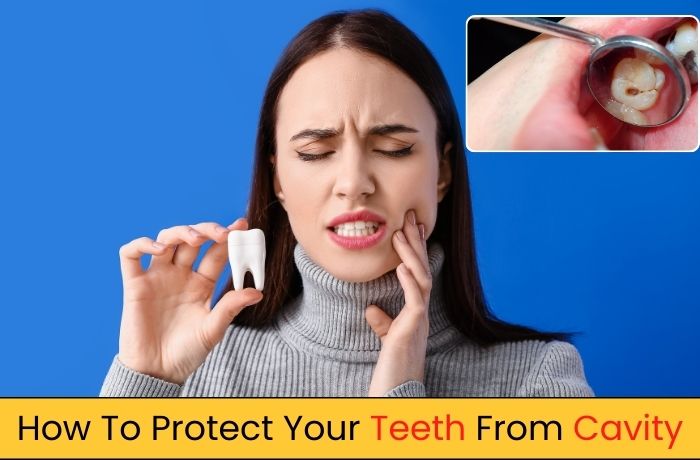 How To Protect Your Teeth From Cavity