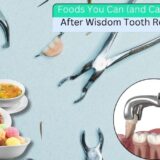 Foods You Can (and Can’t) Eat After Wisdom Tooth Removal