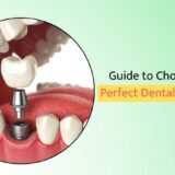 Guide to Choose the Perfect Dental Implants