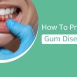 How To Prevent Gum Diseases: