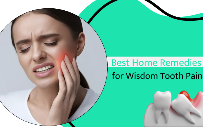 Best Home Remedies for Wisdom Tooth Pain: Effective Ways to Get Quick Relief