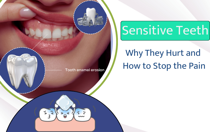 Sensitive Teeth: Why They Hurt and How to Stop the Pain