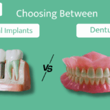 Dental Implants vs. Dentures: How to Choose the Right Option for You