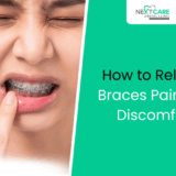 How to Relieve Pain and Discomfort After Getting Braces