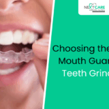 How to Choose the Right Mouth Guard for Teeth Grinding