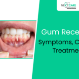 Gum Recession – Symptoms, Causes, Treatment