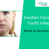 Swollen Face from Tooth Infection – What to Do Immediately