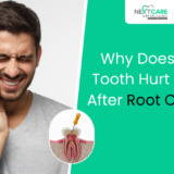Why Does My Tooth Hurt Even After Root Canal? Here's What You Need to Know