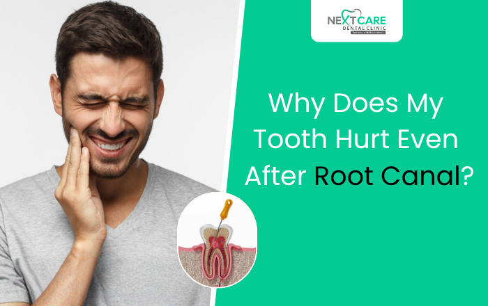 Why Does My Tooth Hurt Even After Root Canal? Here’s What You Need to Know