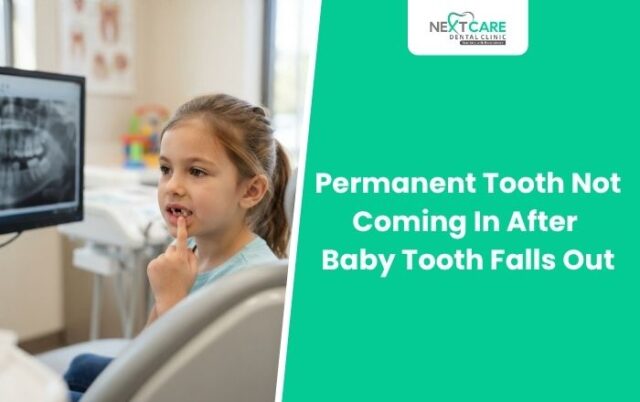 Permanent Tooth Not Coming In After Baby Tooth Falls Out