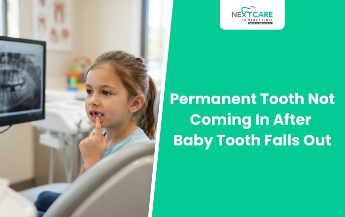 Permanent Tooth Not Coming In After Baby Tooth Falls Out